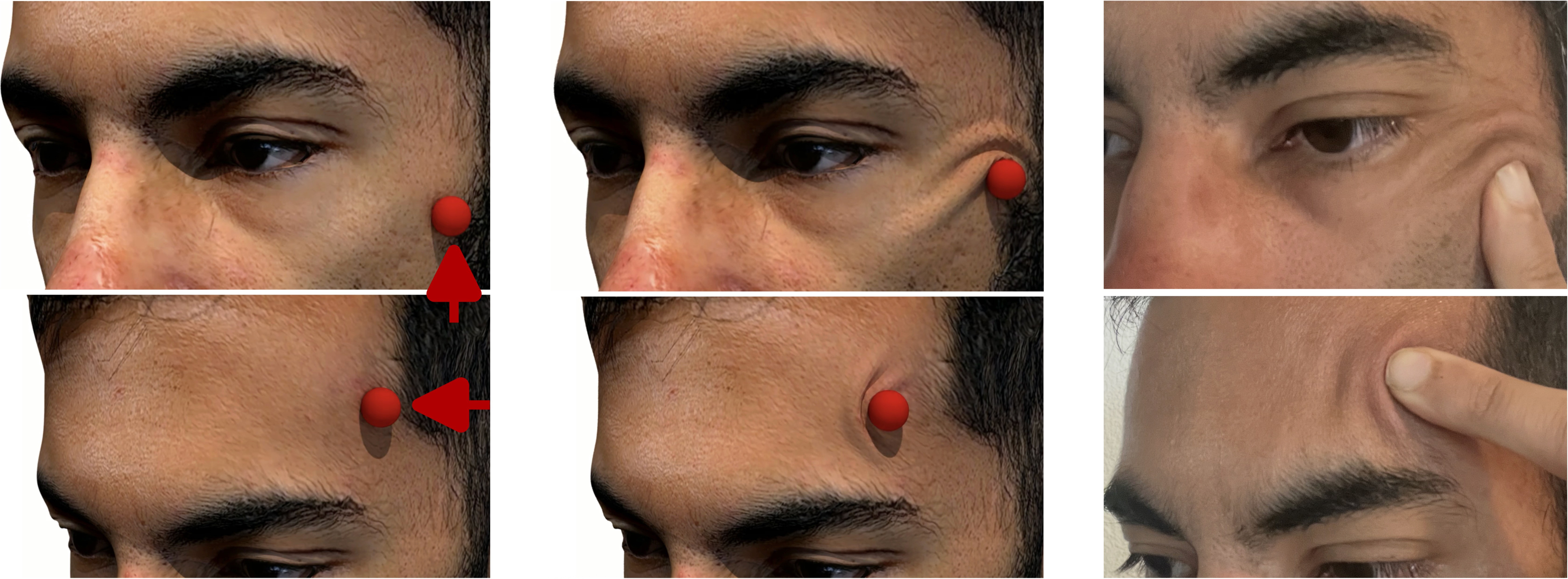 Physics-Based Simulation of Contact-Induced Facial Wrinkling teaser